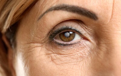 Dr. Hynes: Remove cataracts to restore vision